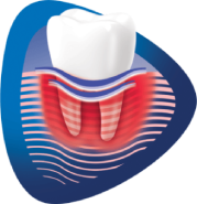 Obraz zęba z niebiesko-czerwoną falą